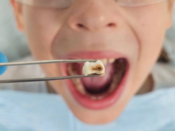 Best Pediatric Emergency Dentist in Lake Ronkonkoma, NY